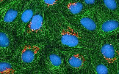 NUEVA PROTEÍNA PARA CORREGIR LA FIBROSIS QUÍSTICA